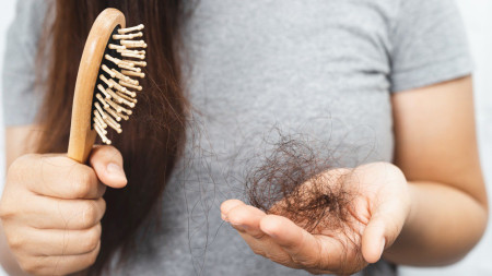 QUEDA DE CABELO ? DESCUBRA COMO LIDAR COM ISSO
